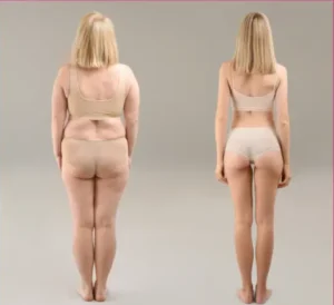 Read more about the article Czy Twoje jelita blokują odchudzanie?